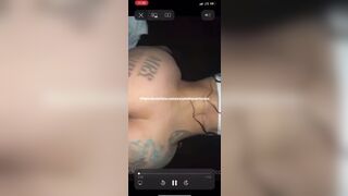 Backshots after the surgery... - Backshots