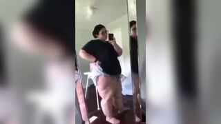 Lipedema