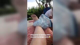 Iskra Lawrence: Hurt Ankle